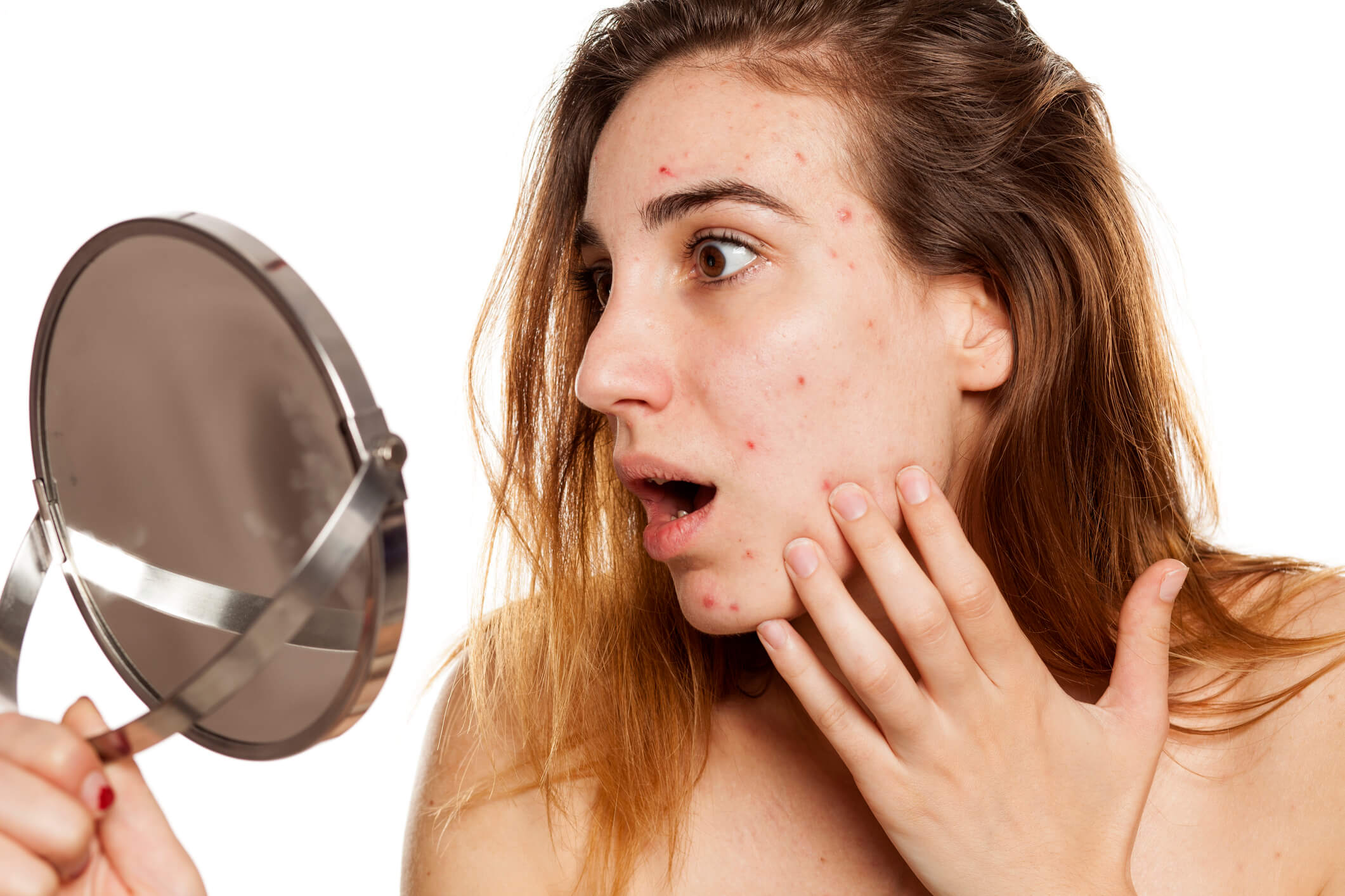 Woman Looking at Mild Acne in Mirror