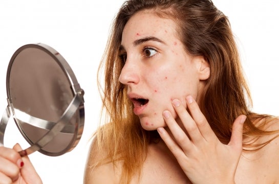 Woman Looking at Mild Acne in Mirror